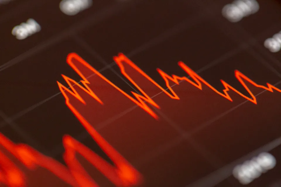 A financial chart on a screen, representing reconciling dashboard totals against Seller Central